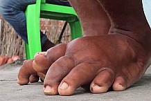 (Vidéo) Brésil: Elle possède des pieds géants