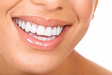 10 astuces faciles pour rendre ses dents plus blanches