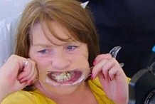 Elle se collait les dents à la glu par peur du dentiste
