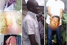 Nigeria : Arrêté pour avoir tué et démembré son ami