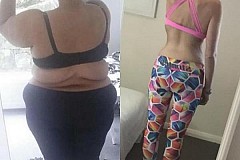 (Photos) Elle perd 90 kg en 1 an… puis elle retire sa peau excédentaire grâce à la chirurgie (Photos) Elle perd 90 kg en 1 an… puis elle retire sa peau excédentaire grâce à la chirurgie