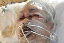 Belgique : Son mari lui taillade le visage, l’asperge d’essence et l'immole