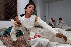 Une Pakistanaise de 20 ans grièvement brûlée pour avoir refusé de se marier Une Pakistanaise de 20 ans grièvement brûlée pour avoir refusé de se marier