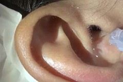 (Vidéo) Il verse un liquide dans son oreille, ce qui en ressort est tout simplement dégoûtant 