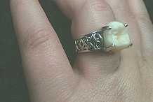 (Photos) Etats-Unis : Pour sa demande en mariage, il offre une bague contenant sa dent