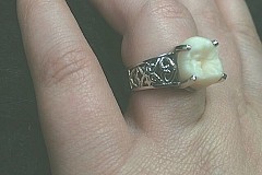 (Photos) Etats-Unis : Pour sa demande en mariage, il offre une bague contenant sa dent (Photos) Etats-Unis : Pour sa demande en mariage, il offre une bague contenant sa dent