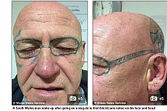 Pays de Galles : Il s'était fait tatouer ses lunettes sur le visage Pays de Galles : Il s'était fait tatouer ses lunettes sur le visage