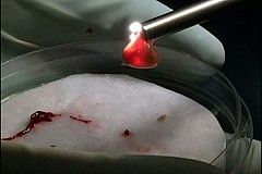 (Vidéo) Un ver solitaire retrouvé dans... le cerveau d'un Américain (Vidéo) Un ver solitaire retrouvé dans... le cerveau d'un Américain