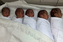 Abidjan : Une femme de 49 ans donne naissance à 5 enfants