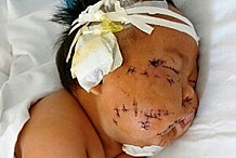 Chine : Pour avoir mordu le sein de sa mère pendant l'allaitement, elle le poignarde à plusieurs reprises