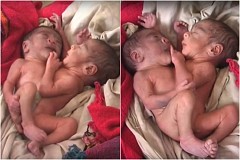 Ces jumeaux siamois sont nés avec deux têtes, quatre bras et deux jambes… et ils vont bien!