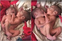 Ces jumeaux siamois sont nés avec deux têtes, quatre bras et deux jambes… et ils vont bien! Ces jumeaux siamois sont nés avec deux têtes, quatre bras et deux jambes… et ils vont bien!