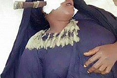 Kenya : Une femme poignardée au visage par son mari