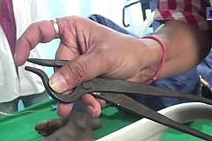 Il parie qu’il peut avaler une pince… et finit à l’hôpital (photo) Il parie qu’il peut avaler une pince… et finit à l’hôpital (photo)