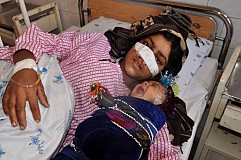Afghanistan : Son fusil s'enraye, il sectionne le nez de sa femme