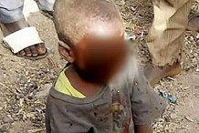 (Photo) Nigeria : Ils crèvent les yeux  d'un enfant  pour un sacrifice rituel