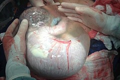 (Vidéo) Venezuela : Un bébé vient au monde dans sa poche amniotique
(Vidéo) Venezuela : Un bébé vient au monde dans sa poche amniotique