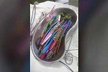 (Vidéo + Photo) Des chirurgiens retirent 18 brosses à dents de l’estomac d’un patient