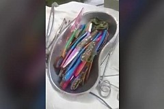 (Vidéo + Photo) Des chirurgiens retirent 18 brosses à dents de l’estomac d’un patient (Vidéo + Photo) Des chirurgiens retirent 18 brosses à dents de l’estomac d’un patient