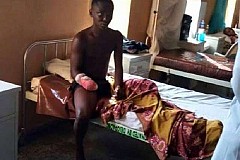 (Photos) Nigeria : Il se fait couper la main en essayant de voler un téléphone à travers une fenêtre



