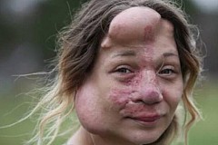 Etats-Unis : Le calvaire de Jennifer, prisonnière de sa maladie
Etats-Unis : Le calvaire de Jennifer, prisonnière de sa maladie