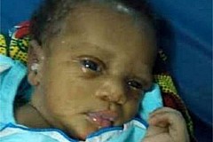 (Photo) Cameroun : Un bébé retrouvé vivant dans une décharge après deux jours