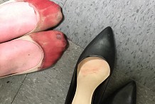 Elle a les pieds en sang parce que son patron la force à travailler en talons
