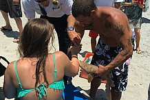 Floride : Elle se présente à l'hôpital avec un requin planté dans le bras
