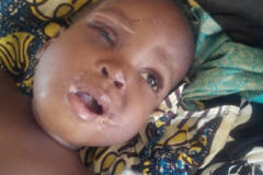 (Photos) Nigeria : En colère, elle castre et brise les membres du fils de deux ans de son mari
