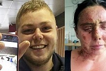 Il jette de l'acide sur une femme puis prend un selfie avec la victime