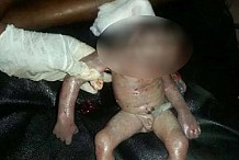 (Photo) Une femme donne naissance à un étrange bébé grenouille