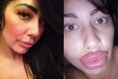 Elle dépense une petite fortune pour avoir les plus grosses lèvres (photos)