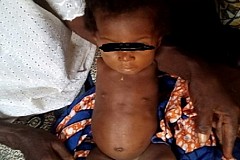 Choc : Un enfant nait sans bras, sa famille sous le choc