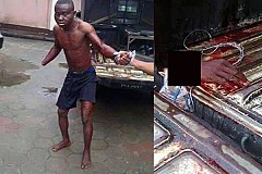 (Photos) Des jeunes en colère coupent la main d'un voleur (Photos) Des jeunes en colère coupent la main d'un voleur