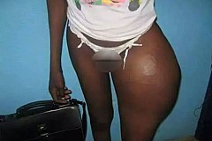 (Photos) Elle tente d'agrandir ses fesses, malheureusement ça tourne mal... (Photos) Elle tente d'agrandir ses fesses, malheureusement ça tourne mal...
