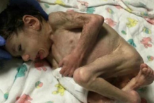 Elle sauve et adopte un enfant bulgare qui ne pesait que 3 kg à 7 ans (photos)