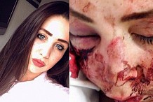 A 16 ans, elle tabasse et déshabille une fille pour lui voler son iphone 