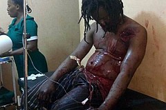 Ghana: Un féticheur lâché par ses esprits gravement blessé lors d'une démonstration de puisance