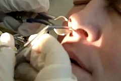 Un homme se fait retirer une crotte de nez géante (vidéo) Un homme se fait retirer une crotte de nez géante (vidéo)