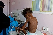 Le Yémen face à la «pire crise humanitaire de la planète»