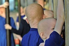Mali/Crime rituel: Une fillette albinos kidnappée et égorgée Mali/Crime rituel: Une fillette albinos kidnappée et égorgée