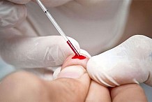 Se dirige-t-on vers un vaccin contre le VIH ?