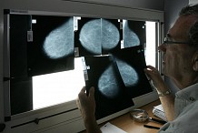 18,1 millions de nouveaux cas de cancer en 2018