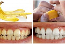 Comment blanchir les dents avec des pelures de banane