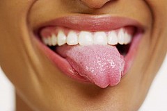 5 choses que votre apparence de langue dit sur votre santé