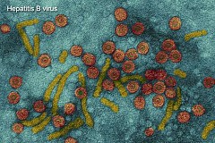 Le virus de la négligence de l'hépatite B entraîne le cancer du foie 