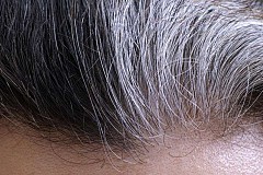 Cheveux gris prématurés
Voici comment inverser cette condition naturellement
Cheveux gris prématurés
Voici comment inverser cette condition naturellement