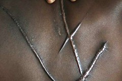 5 astuces beauté pour éliminer les cicatrices à la maison 5 astuces beauté pour éliminer les cicatrices à la maison