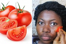 5 raisons pour lesquelles les tomates sont bonnes pour la peau