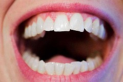 Types de dents et leurs problèmes communs